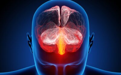 Migraña: Cuando la cabeza no da mas