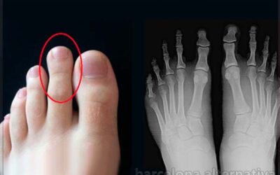 Que significa tener el segundo dedo más largo que el pulgar