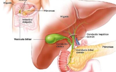 5 CONSEJOS PARA REPARAR EL HÍGADO DAÑADO